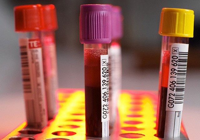 WHO publishes latest diagnostic criteria for diabetes 2019