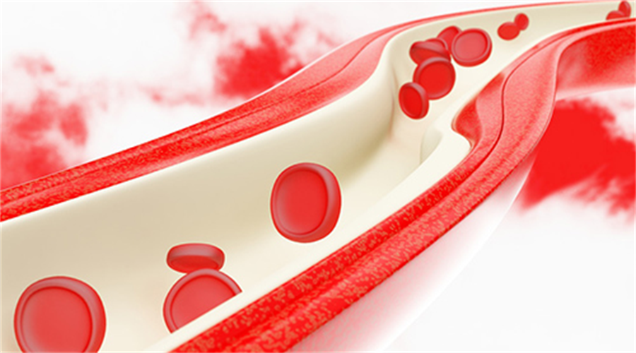 Glycosylated Hemoglobin