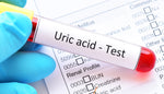 What Should People with High Uric Acid Do at Home 2021?